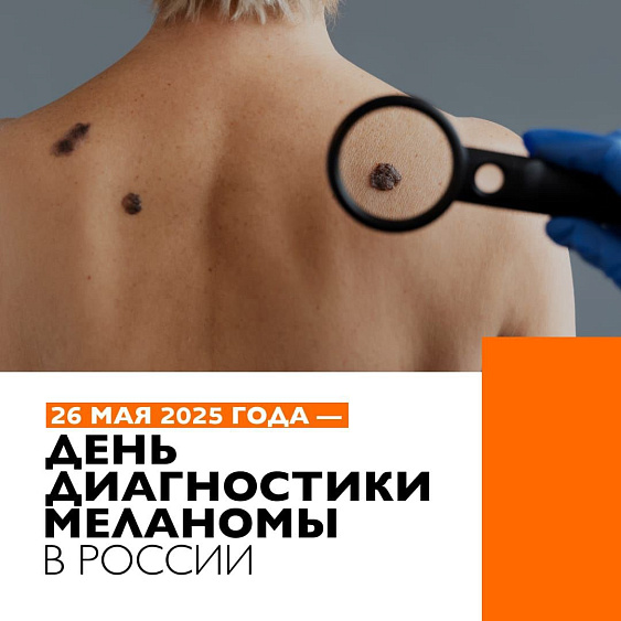 Бесплатная диагностика меланомы в Биомедицине